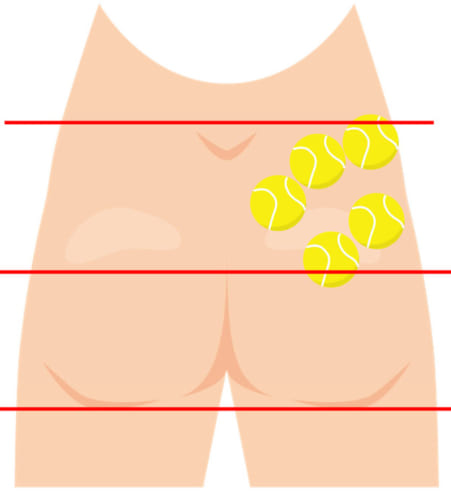 図は殿部を後ろから見たところです。